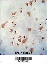 Anti-WDR48 Rabbit Polyclonal Antibody (HRP (Horseradish Peroxidase))