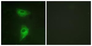 Immunofluorescence analysis of HeLa cells using Anti-IGF2R Antibody The right hand panel represents a negative control, where the antibody was pre-incubated with the immunising peptide