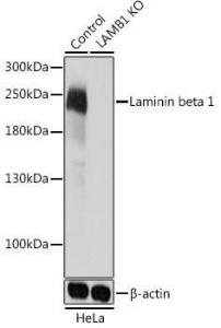 Western blot analysis of extracts from normal (control) and Laminin beta 1 knockout (KO) HeLa cells, using Anti-Laminin beta 1 Antibody (A305675) at 1:1,000 dilution. The secondary antibody was Goat Anti-Rabbit IgG H&L Antibody (HRP) at 1:10,000 dilution.