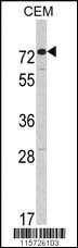 Anti-ADAL Rabbit Polyclonal Antibody