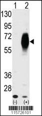 Anti-AMHR2 Rabbit Polyclonal Antibody