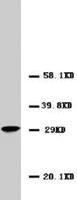 Anti-CALB2 Rabbit Polyclonal Antibody