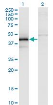 Anti-ZFYVE19 Mouse Monoclonal Antibody [clone: 3G4-2B11]