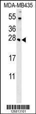 Anti-CD63 Rabbit Polyclonal Antibody (HRP (Horseradish Peroxidase))