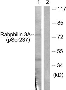 Western blot analysis of lysates from RAW264.7 cells treated with Calyculin 100nM 15' using Anti-Rabphilin 3A (phospho Ser237) Antibody. The right hand lane represents a negative control, where the antibody is blocked by the immunising peptide.