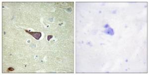 Immunohistochemical analysis of paraffin-embedded human brain tissue using Anti-IGF2R Antibody The right hand panel represents a negative control, where the antibody was pre-incubated with the immunising peptide