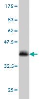 Anti-ZAK Mouse Monoclonal Antibody [clone: 4C4]