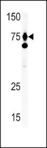 Anti-HGF Rabbit Polyclonal Antibody (AP (Alkaline Phosphatase))