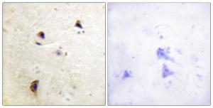 Immunohistochemical analysis of paraffin-embedded human brain using Anti-Rabphilin 3A (phospho Ser237) Antibody. The right hand panel represents a negative control, where the antibody was pre-incubated with the immunising peptide.