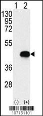 Anti-PRDM2 (RIZ1) Mouse Monoclonal Antibody