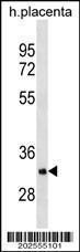 Anti-OR5B12 Mouse Monoclonal Antibody [clone: 609CT8.2.4]