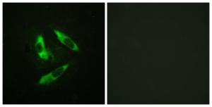 Immunofluorescence analysis of HeLa cells using Anti-Rabphilin 3A (phospho Ser237) Antibody. The right hand panel represents a negative control, where the antibody was pre-incubated with the immunising peptide.