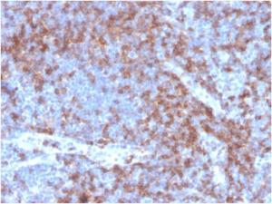 Immunohistochemical analysis of formalin-fixed, paraffin-embedded human tonsil using Anti-CD22 Antibody [BLCAM/2637R]