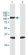 Anti-SF3B2 Mouse Polyclonal Antibody