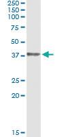 Anti-HOXD1 Antibody Pair