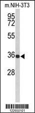 Anti-SLC25A17 Rabbit Polyclonal Antibody (APC (Allophycocyanin))