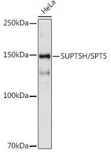 Western blot analysis of extracts of HeLa cells, using Anti-SPT5 Antibody [ARC2380] (A308173) at 1:1,000 dilution