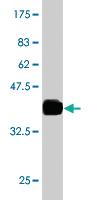 Anti-RAB27A Mouse Monoclonal Antibody [clone: 1G7]