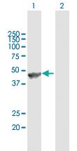 Anti-ANGPTL5 Mouse Polyclonal Antibody