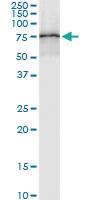 Anti-PAPSS2 Polyclonal Antibody Pair