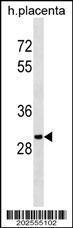 Anti-OR5B12 Mouse Monoclonal Antibody [clone: 609CT8.2.4]