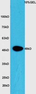 Anti-CTBP1 Rabbit Polyclonal Antibody