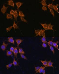 Immunofluorescence analysis of NIH/3T3 cells using Anti-CD133 Antibody (A12549) at a dilution of 1:100. DAPI was used to stain the cell nuclei (blue)