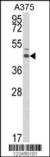 Anti-TRIP10 Rabbit Polyclonal Antibody