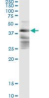 Anti-ZFYVE19 Mouse Monoclonal Antibody [clone: 3G4-2B11]