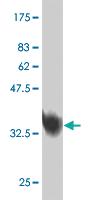 Anti-MED31 Mouse Monoclonal Antibody [clone: 2C8]