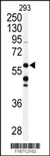 Anti-ADCK3 Rabbit Polyclonal Antibody