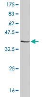 Anti-HRSP12 Mouse Monoclonal Antibody [clone: 2B8]