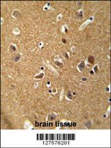 Anti-DAGLA Rabbit Polyclonal Antibody (FITC (Fluorescein Isothiocyanate))