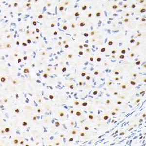 Immunohistochemistry analysis of paraffin-embedded rat ovary using Anti-SPT5 Antibody [ARC2380] (A308173) at a dilution of 1:100 (40X lens). Perform microwave antigen retrieval with 10 mM Tris/EDTA buffer pH 9.0 before commencing with IHC staining protocol