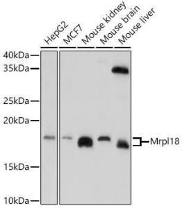 Western blot analysis of extracts of various cell lines, using Anti-Mrpl18 Antibody (A305677) at 1:1000 dilution. The secondary Antibody was Goat Anti-Rabbit IgG H&L Antibody (HRP) at 1:10000 dilution