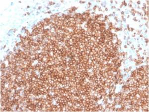 Immunohistochemical analysis of formalin-fixed, paraffin-embedded human tonsil using Anti-CD22 Antibody [BLCAM/2637R]