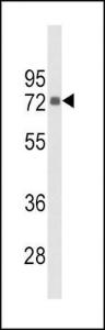 Anti-PIP5K1C Rabbit Polyclonal Antibody (Biotin)