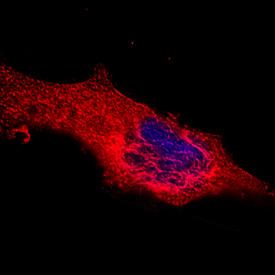 Anti-KRT18 Mouse Monoclonal Antibody [clone: 810811]