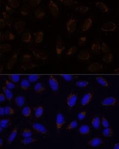 Immunofluorescence analysis of U-2 OS cells using Anti-CD133 Antibody (A12549) at a dilution of 1:100. DAPI was used to stain the cell nuclei (blue)