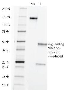 SDS-PAGE analysis of Anti-TAG72 Antibody [B72.3] under non-reduced and reduced conditions; showing intact IgG and intact heavy and light chains, respectively. SDS-PAGE analysis confirms the integrity and purity of the Antibody