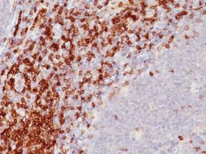 Anti-CD5 Mouse Monoclonal Antibody [clone: SPM546]