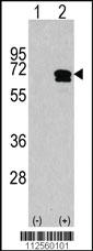 Anti-CAMKK2 Rabbit Polyclonal Antibody