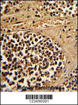 Anti-TRIP10 Rabbit Polyclonal Antibody