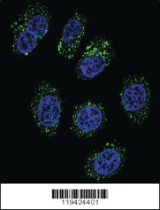 Anti-CMGA Rabbit Polyclonal Antibody