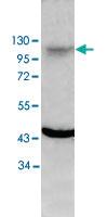 Anti-ACE2 Rabbit Polyclonal Antibody