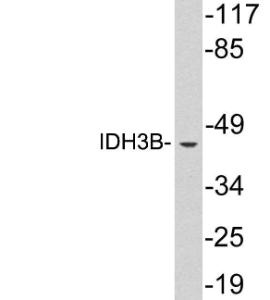 Antibody anti-IDH3B 100 µg