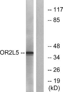 Western blot analysis of lysates from COLO cells using Anti-OR2L5 Antibody The right hand lane represents a negative control, where the antibody is blocked by the immunising peptide