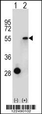 Anti-TRIP10 Rabbit Polyclonal Antibody