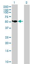 Anti-HGD Mouse Polyclonal Antibody