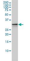 Anti-UBE2Q2 Mouse Monoclonal Antibody [clone: 5E7]